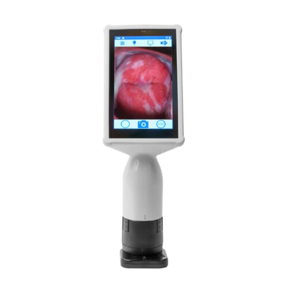 GyneBio Cervical Cancer Screening Device