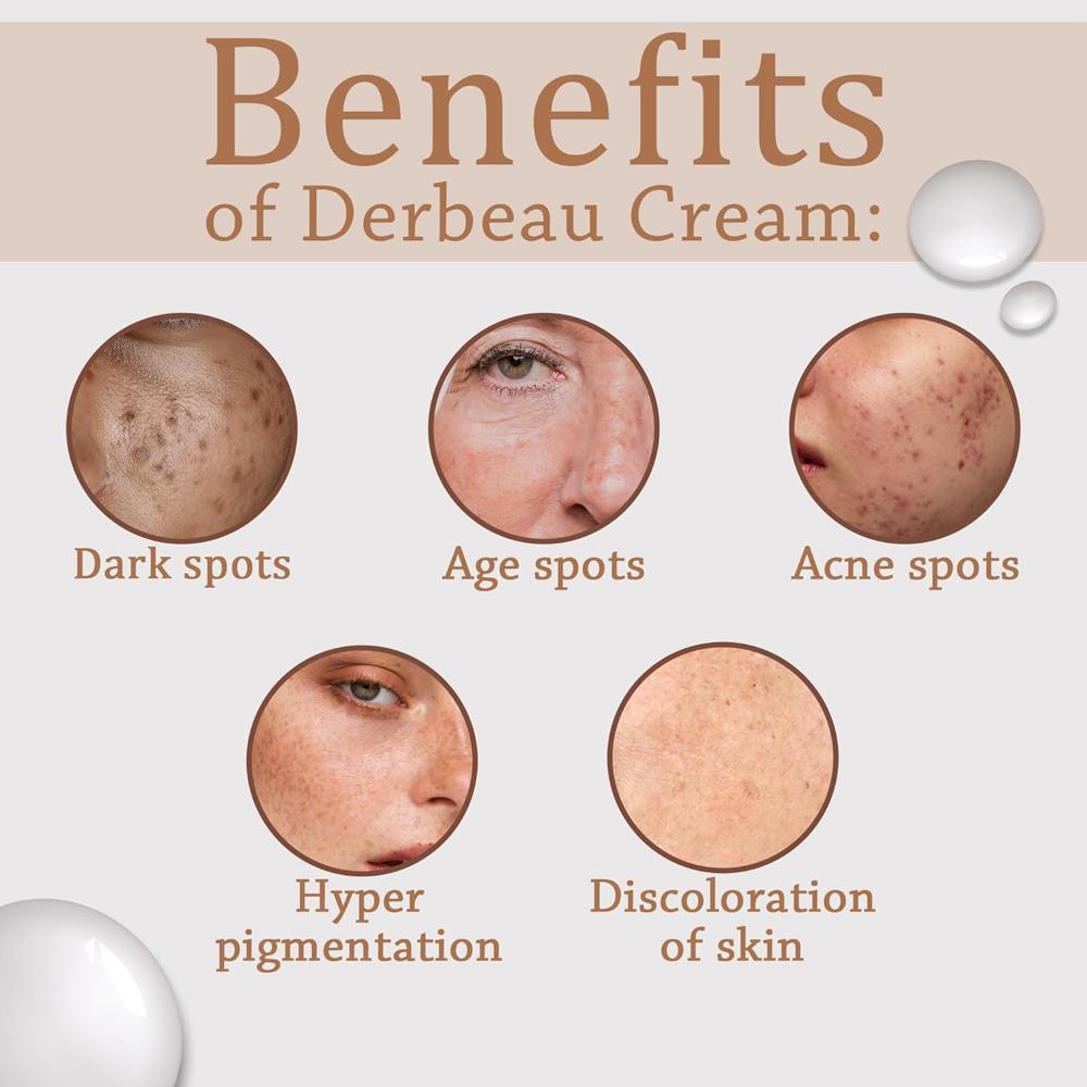 Derbeu 6% Cream