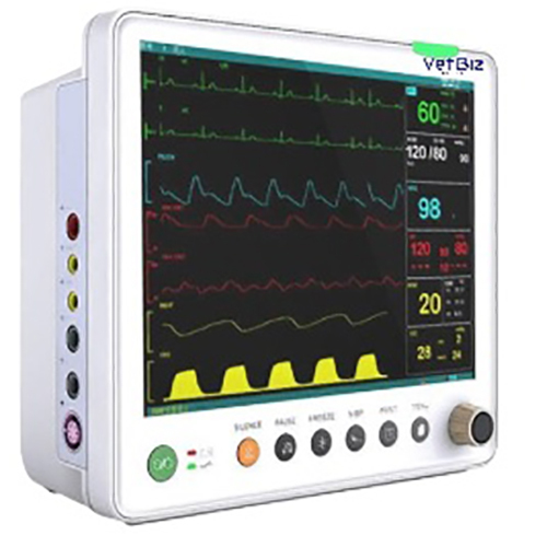 Patient Monitor