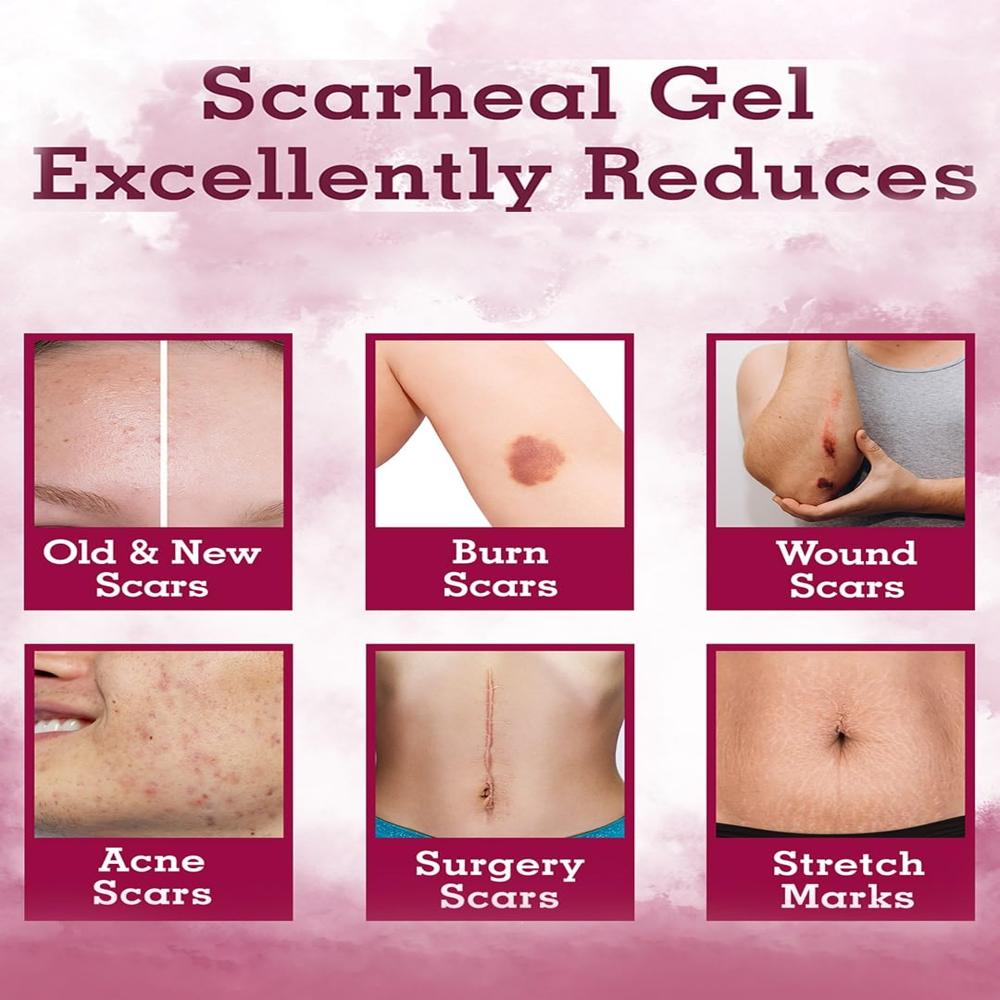Scarheal Gel 15gm