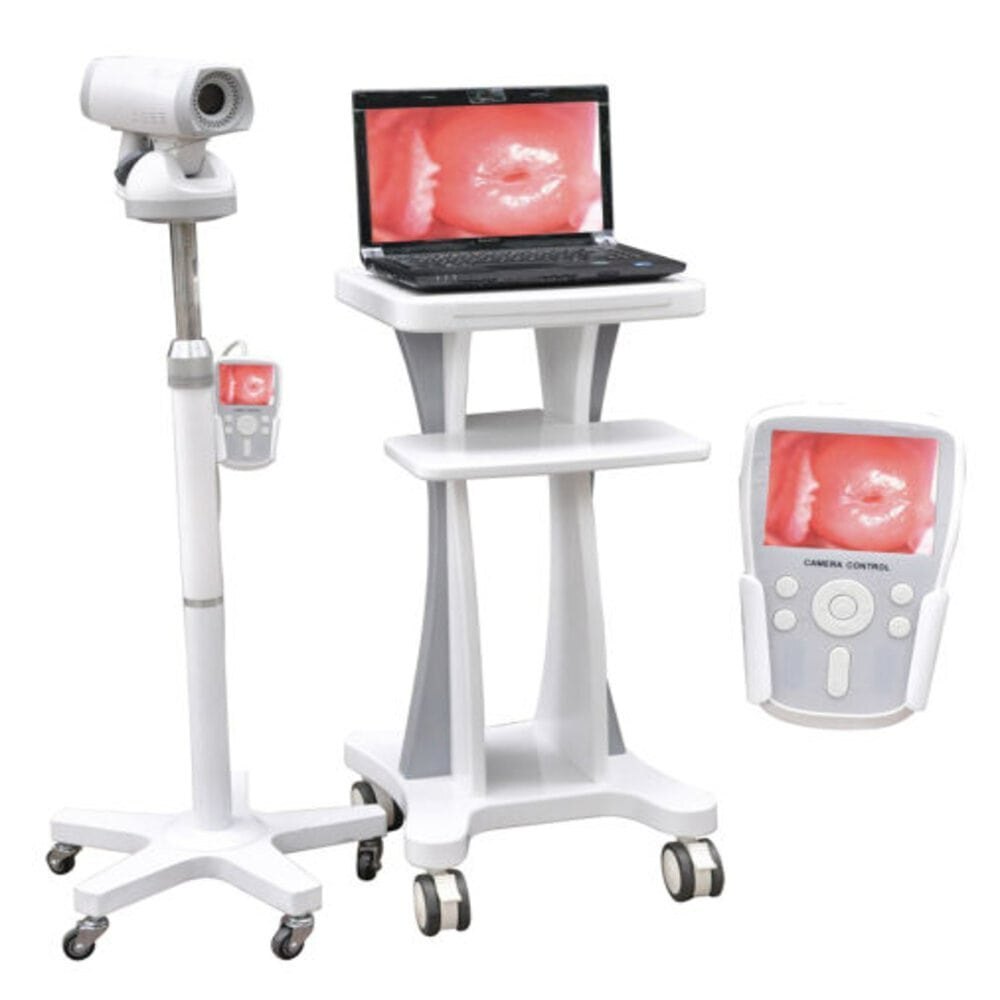 Digital Video Colposcope - Dimension (L*w*h): 240 Mm X 145 Mm X 325 Mm