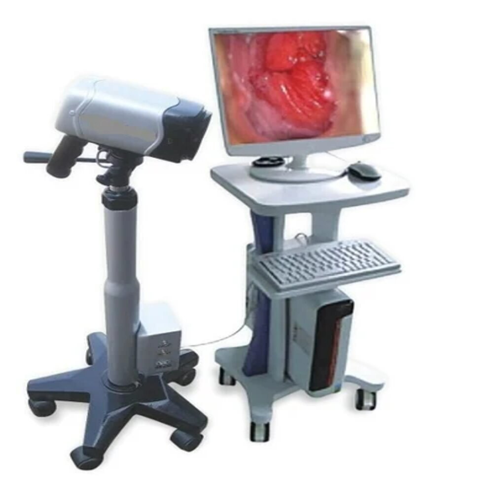 Digital Video Colposcope - Dimension (L*w*h): 240 Mm X 145 Mm X 325 Mm