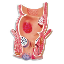 रेड पाइल्स मॉडल