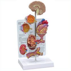 Plastic Hypertension Models