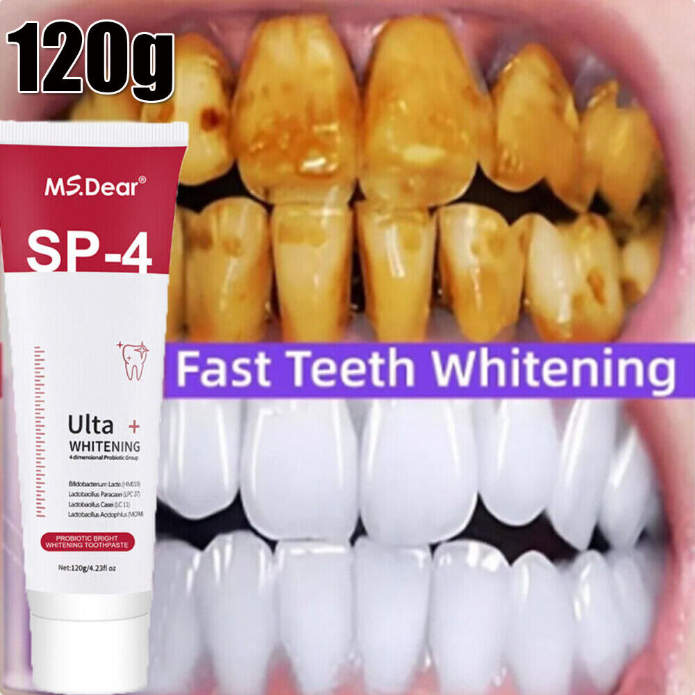 30gm Sp-4 Teeth Whitening Toothpaste