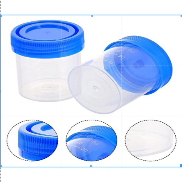 30ml Non-Sterile Urine Sample Container