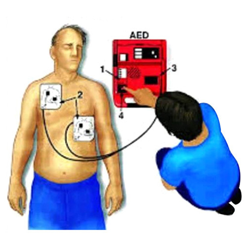 Automated External Defibrillator