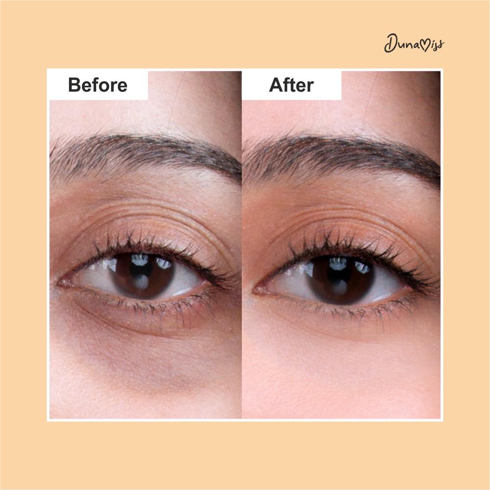 Eye Balm - Attributes: Uv Blocking