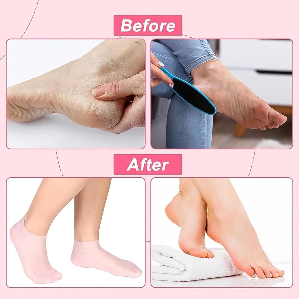 Silicone Moisturizing Socks (1 Pair) - Application: As Per Product Requirement