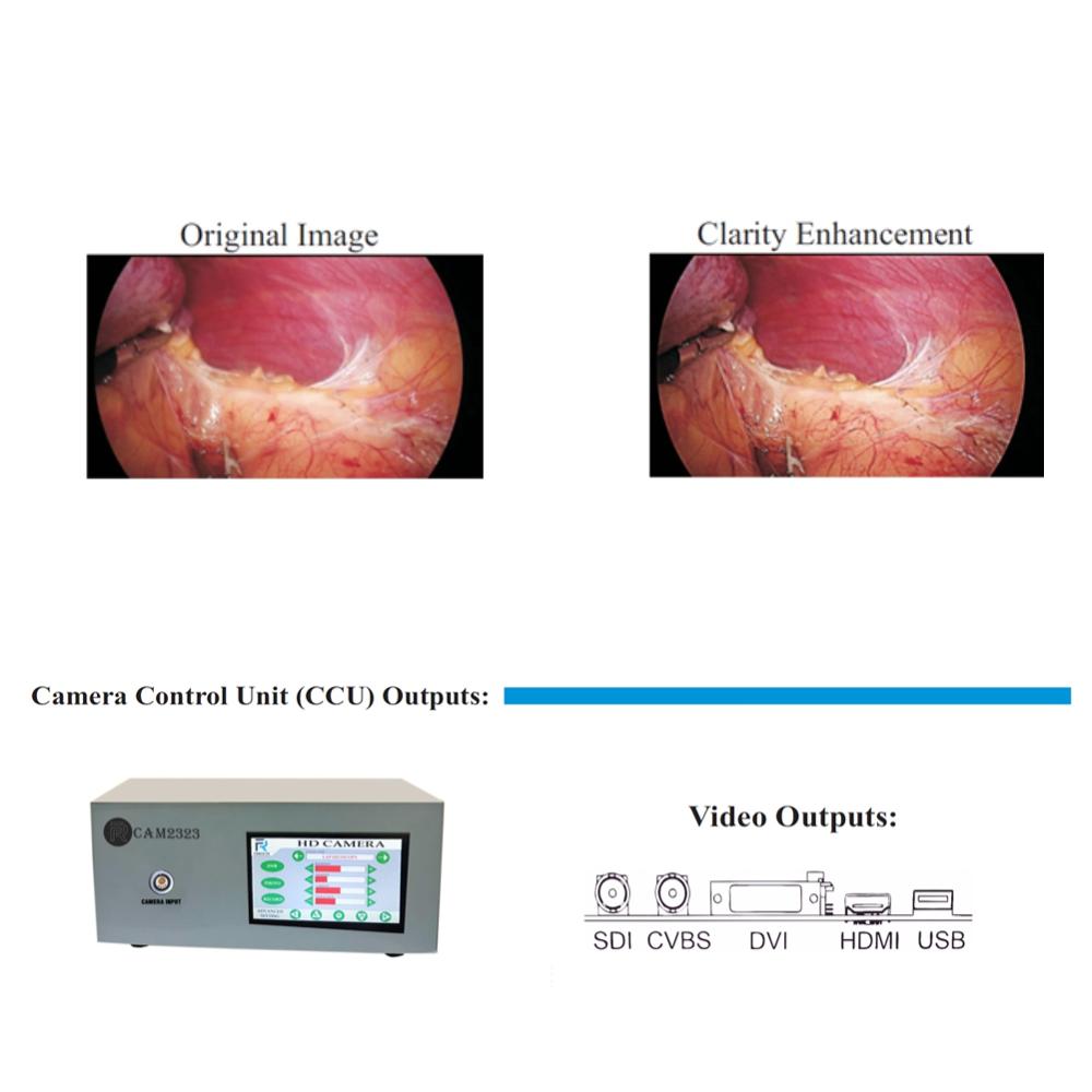 Laparoscopic Hd Camera - Frcam2323 - Accuracy: 98% %