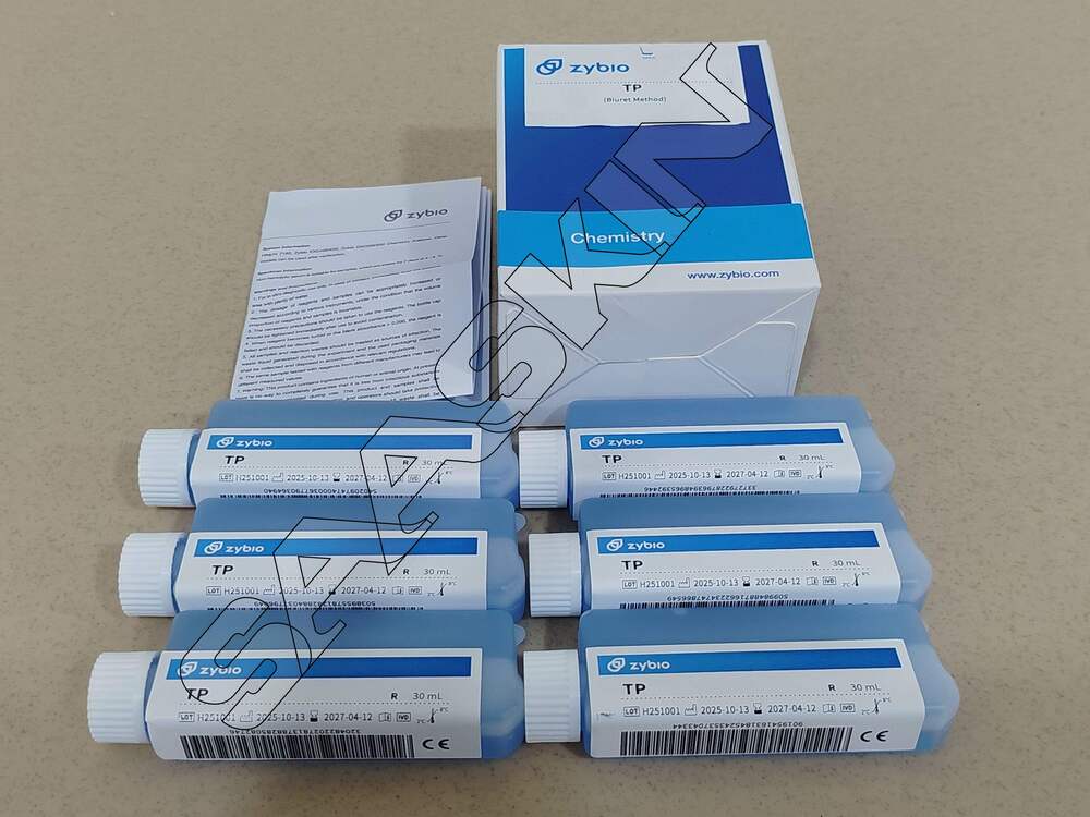 EXC Total Protein (TP)