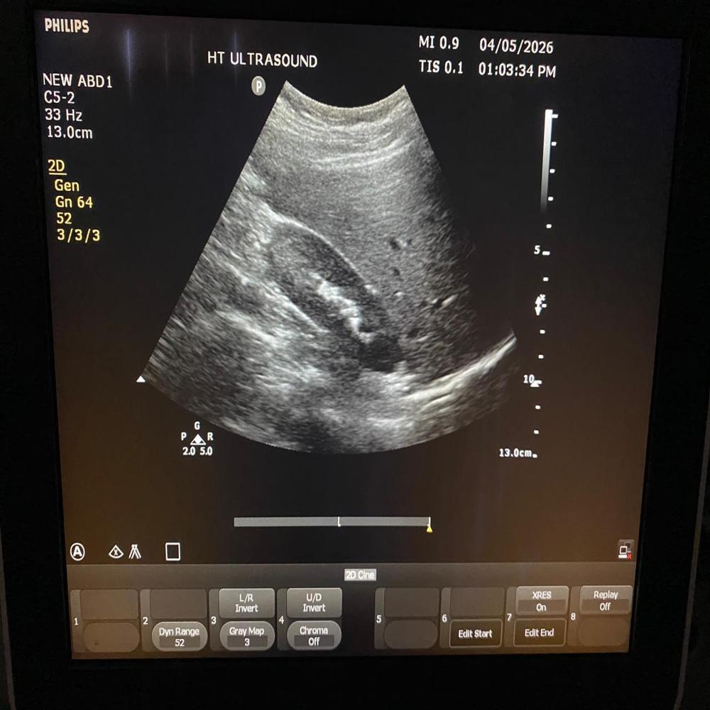 Philips Cv350 Ultrasound Machine
