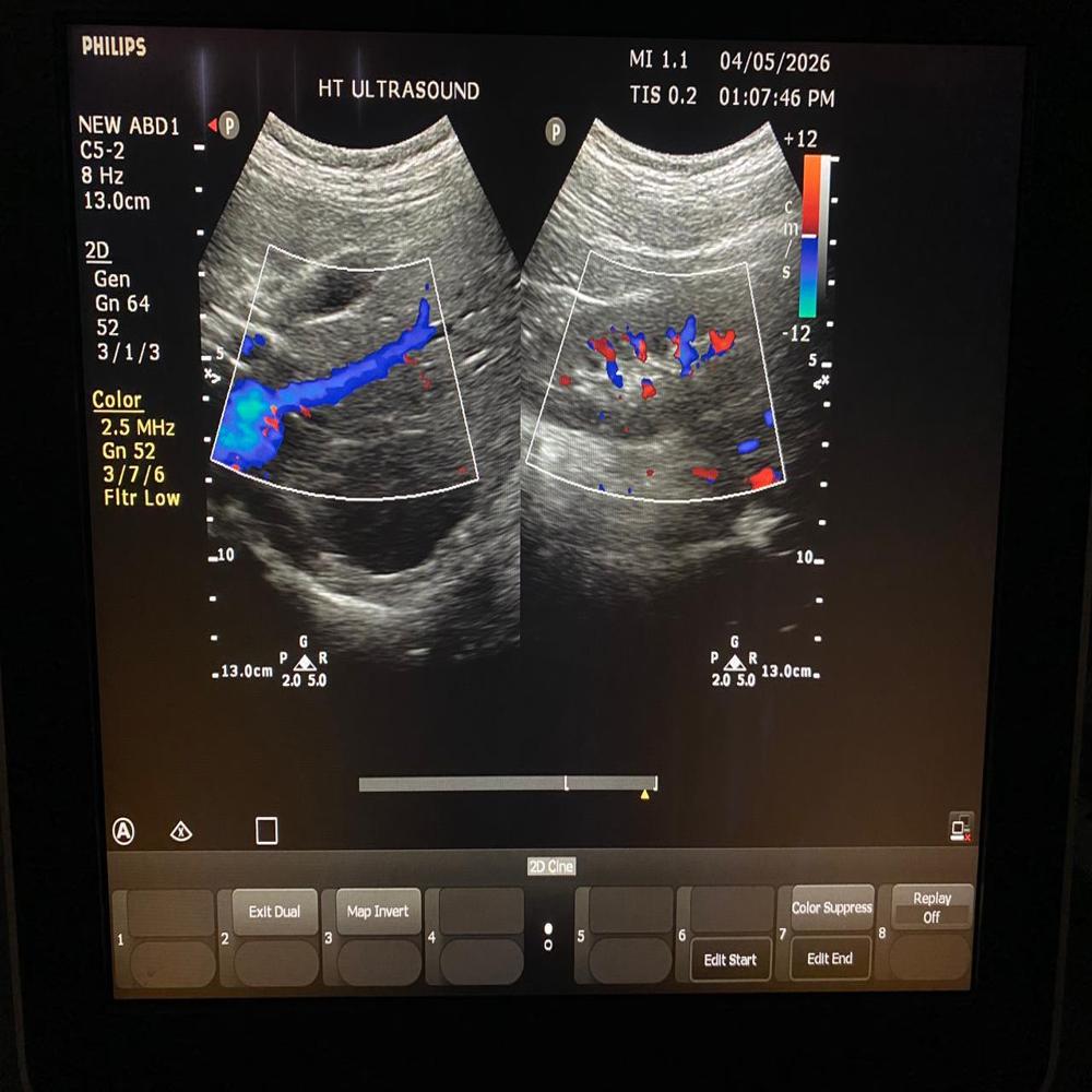 Philips Cv350 Ultrasound Machine