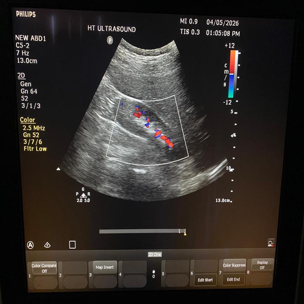 Philips Cv350 Ultrasound Machine