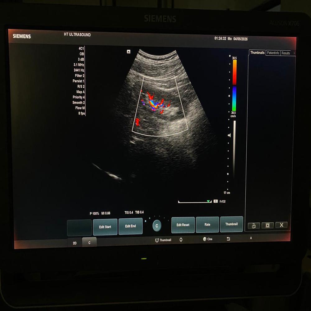 Siemens X700 Ultrasound Machine