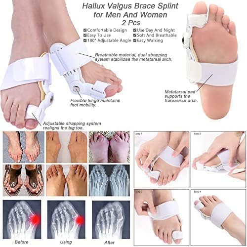 Toe Straightener Bunion Corrector Splint