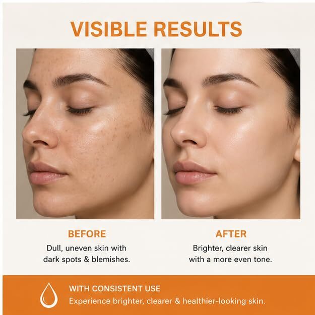 Elyndra Spot Removal Face Serum
