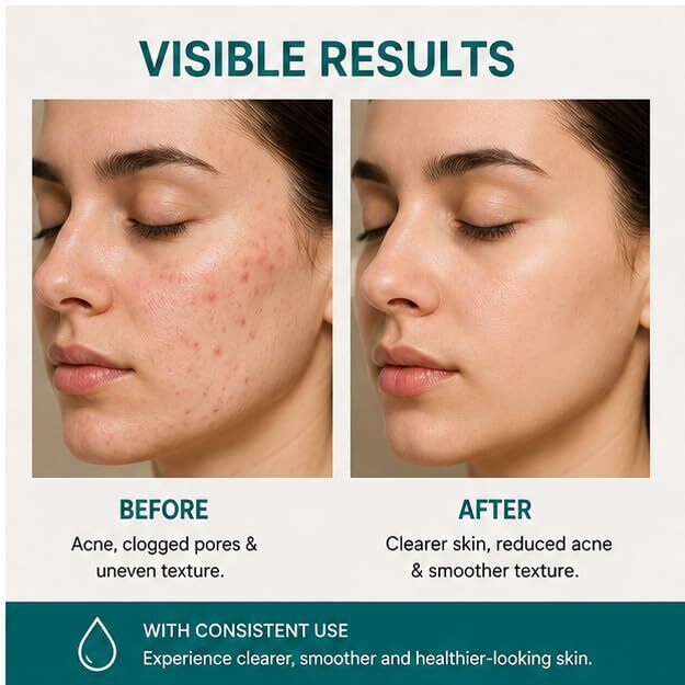 Elyndra 1% Salicylic Acid Face Serum