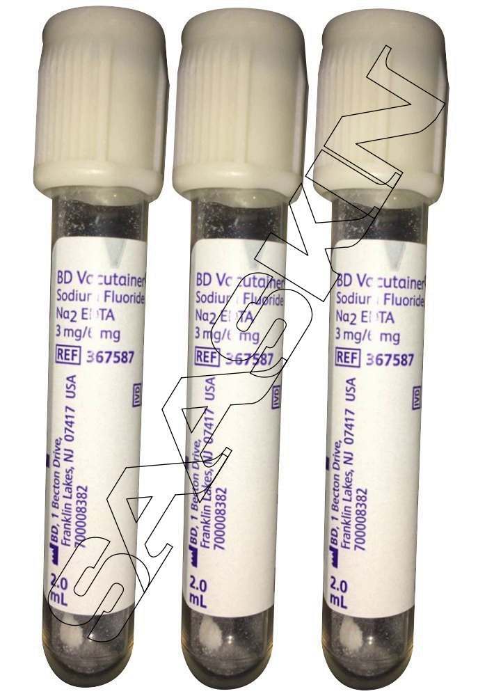 BD Sodium fluoride 3mg , Na2 EDTA 6mg Blood Collection Tube