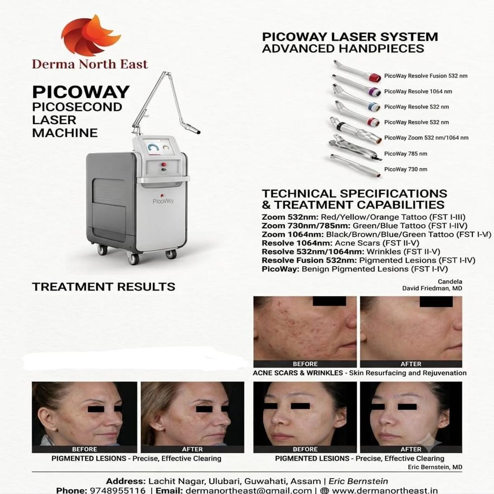 Candela Picosecond Laser Machine