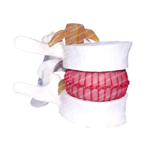 SB-0034 Human Disc Prolapse Simulator