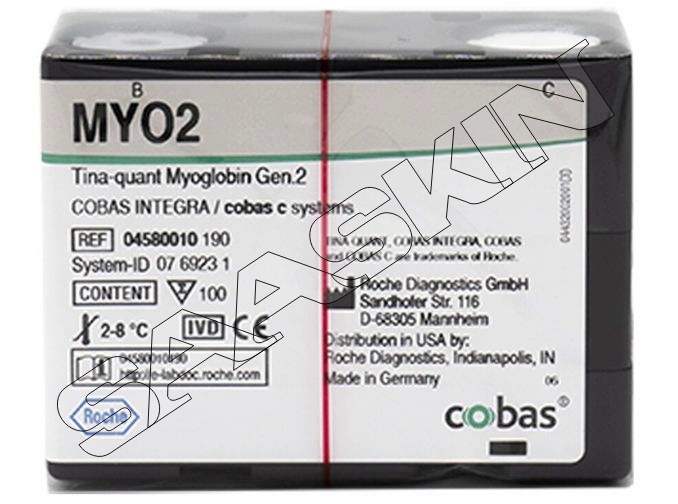 Roche Cobas C Myoglobin