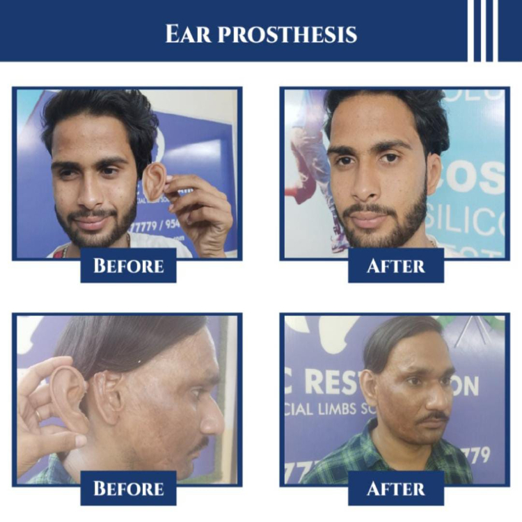 कॉस्मेटिक रिस्टोरेशन ईयर