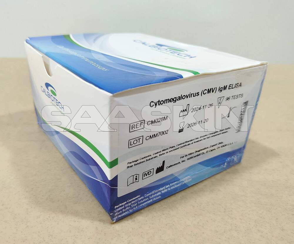 Calbiotech CMV IgM ELISA