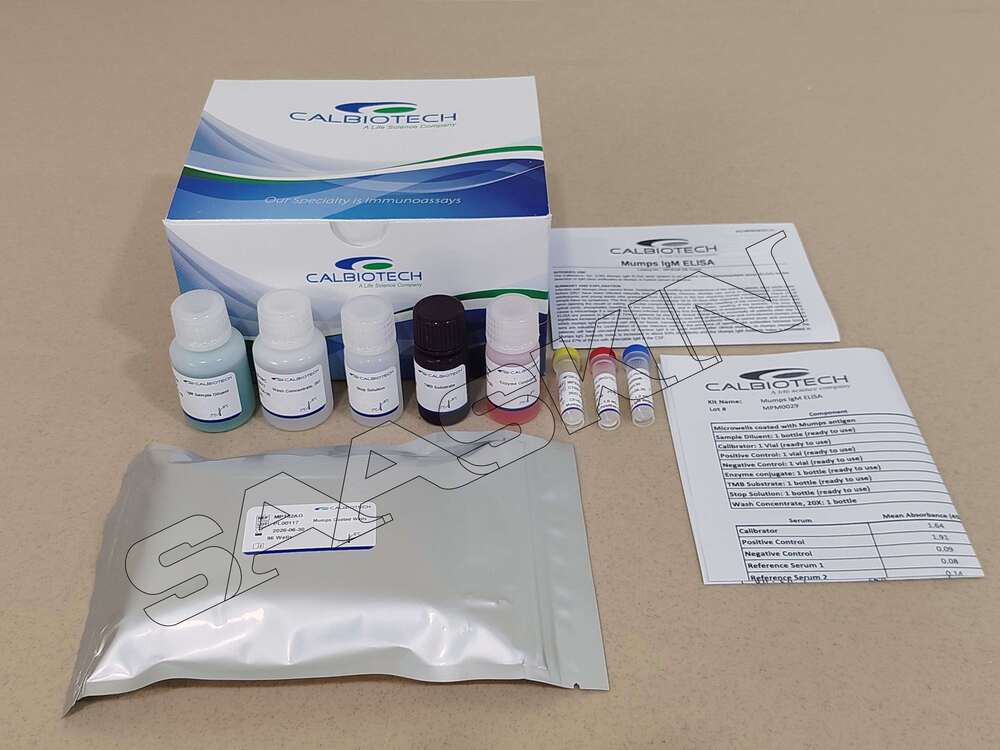 Calbiotech Mumps IgM ELISA