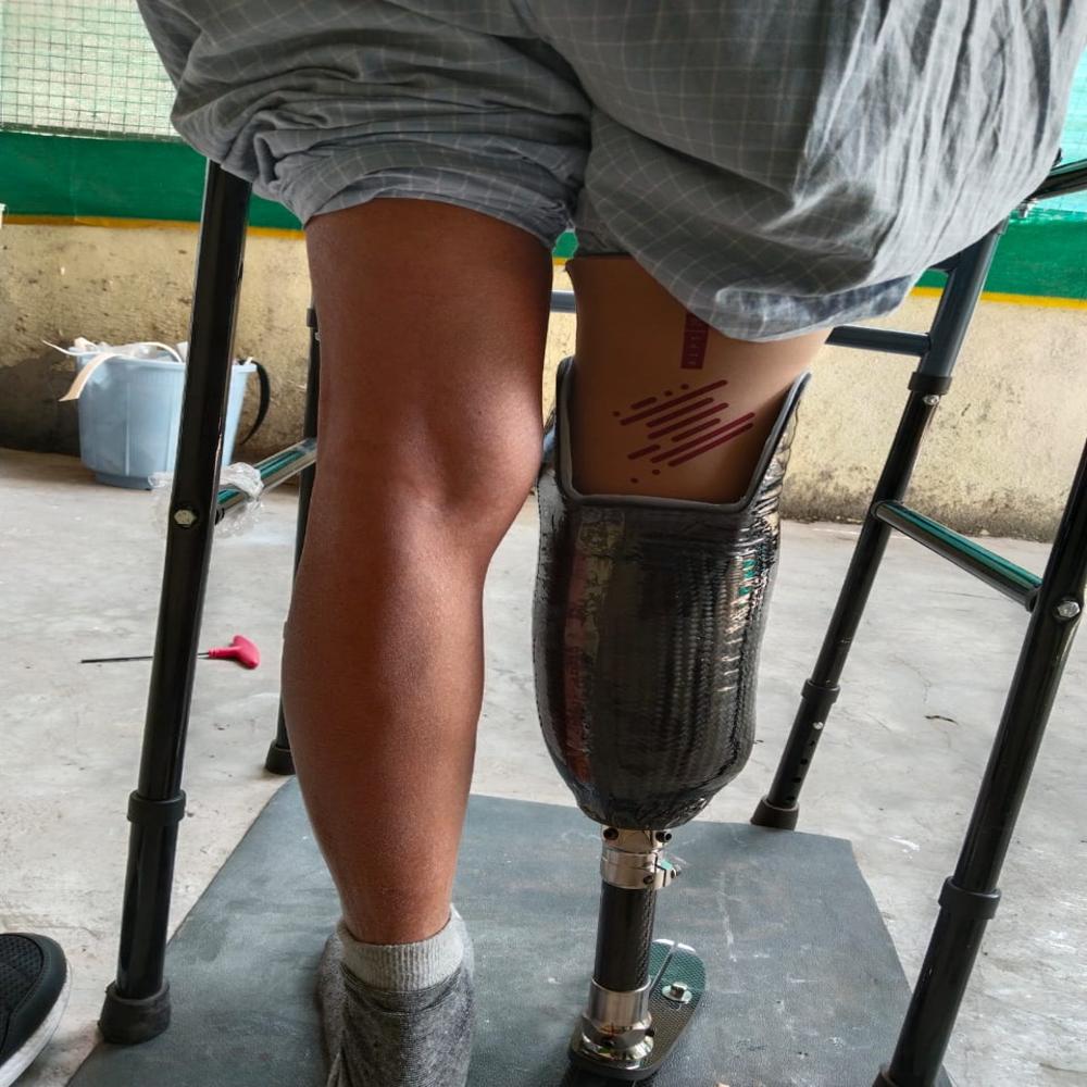 Prosthetics Leg