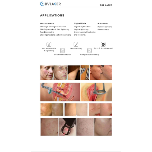 Hair Removal Laser Machine