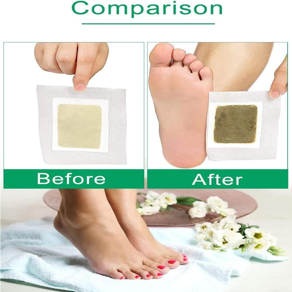 Premium Detox Foot patches 30 pads, Cleansing Toxin Remover Foot Pads, Pain Relief, Stress Relief Sleep Patch for Detoxification, For Men & Women