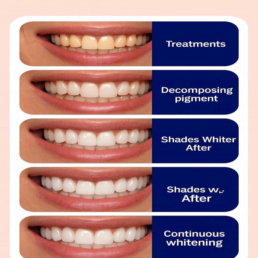 7 Pcs Teeth Strip