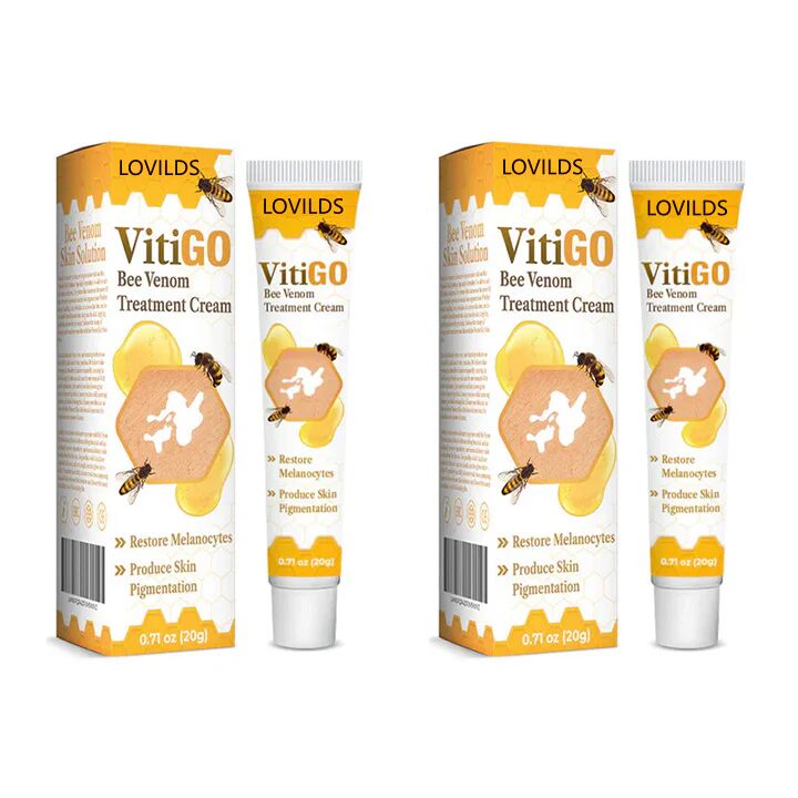20g Vitigo Bee venm cream