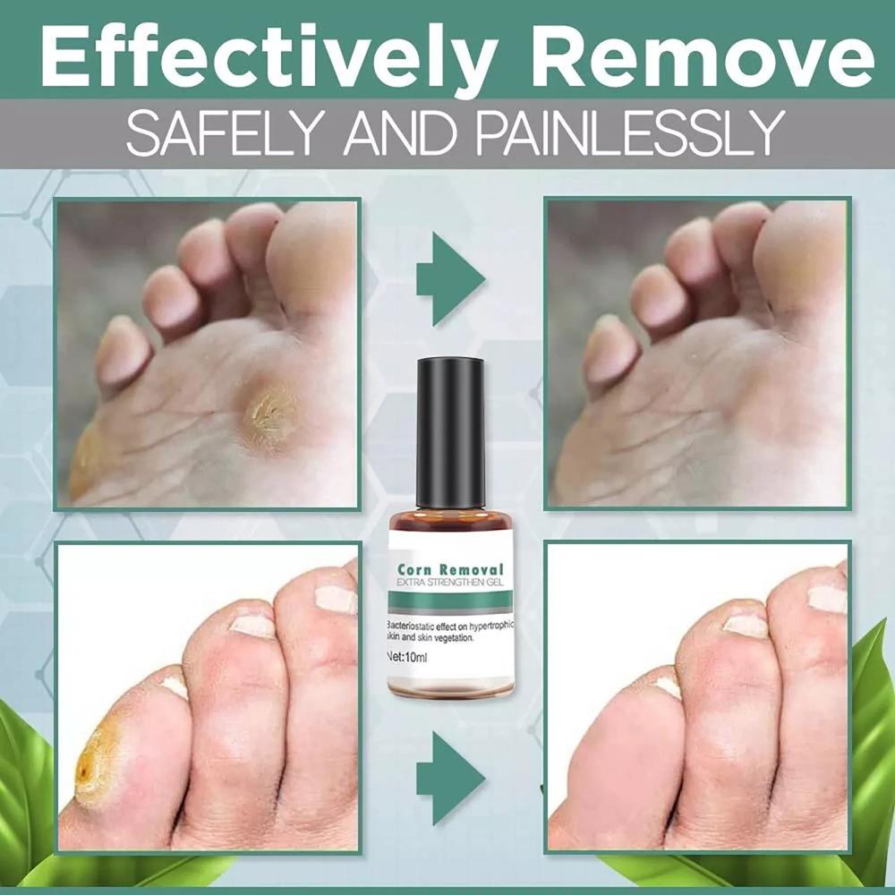 Foot Corn Nail Repair/ Nail Fungus Oil 30ml