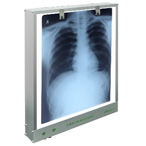 X-Ray Viewer