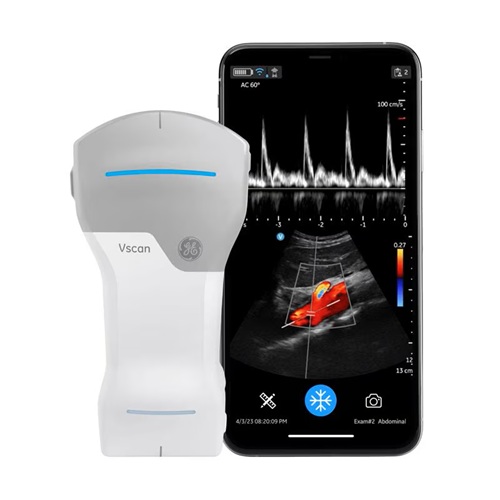 GE Vscan Air CL Portable Ultrasound