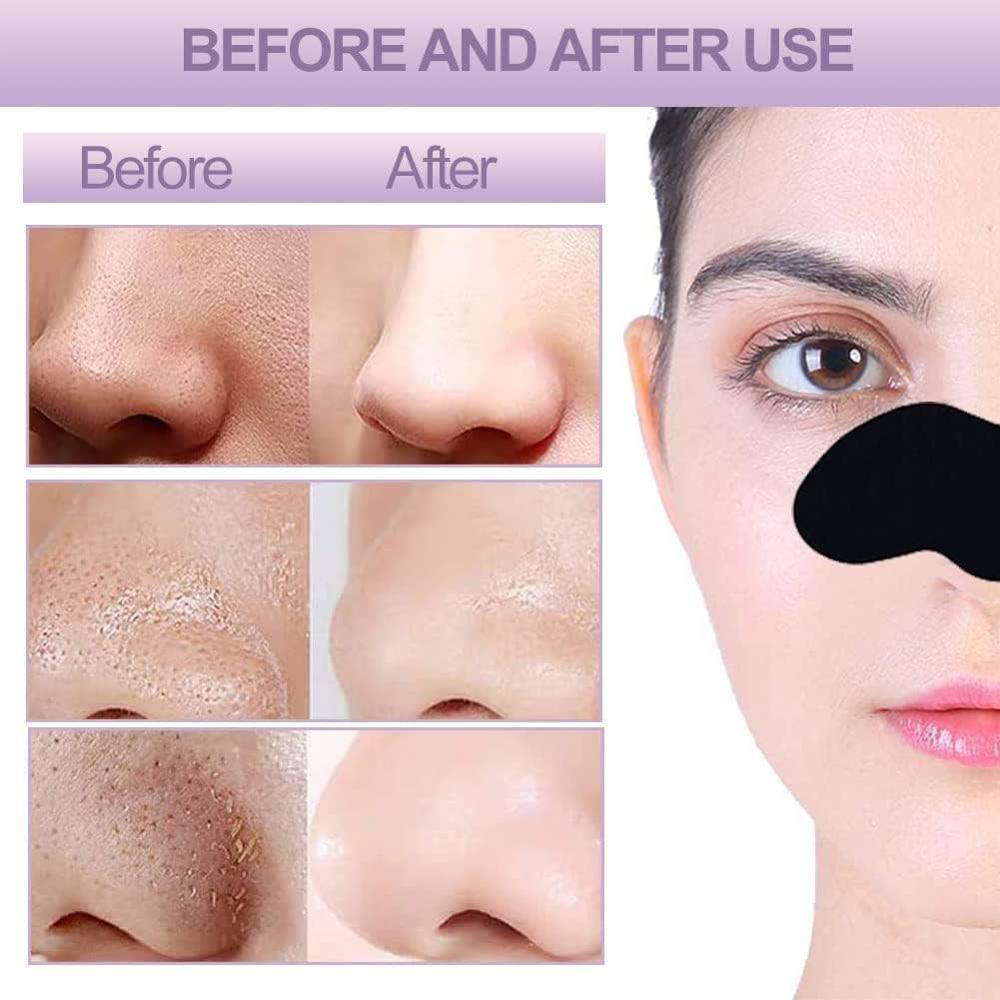 Blackhead Remover Nose Pore Cleansing Strips