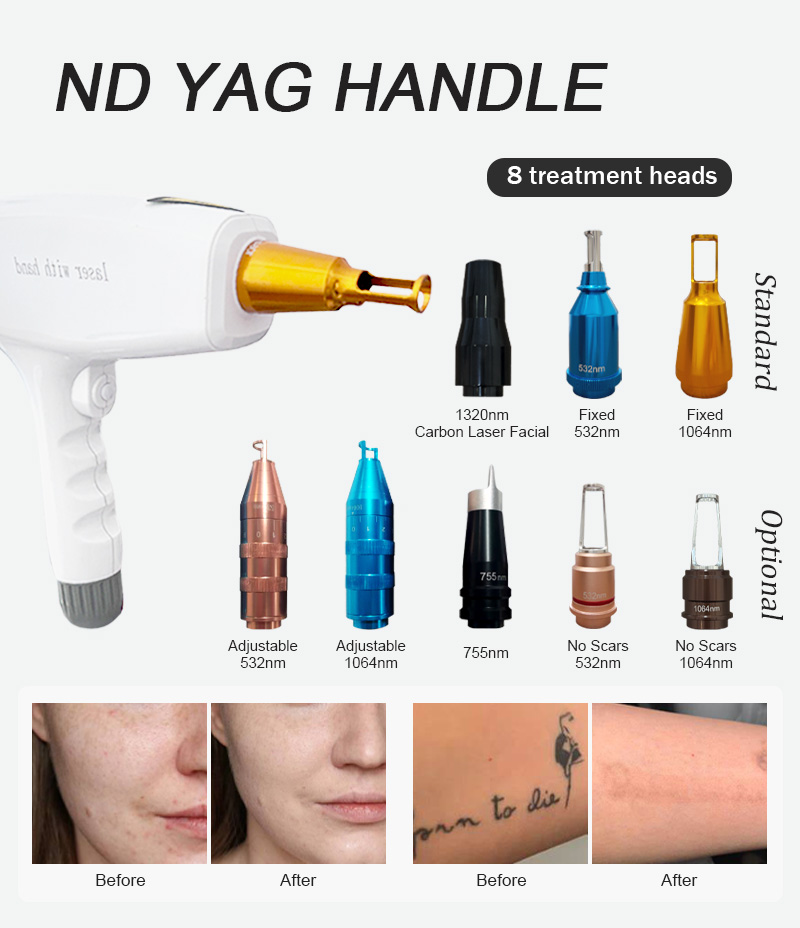  808+IPL+PICO 3 in 1 system Hair Removal Machine