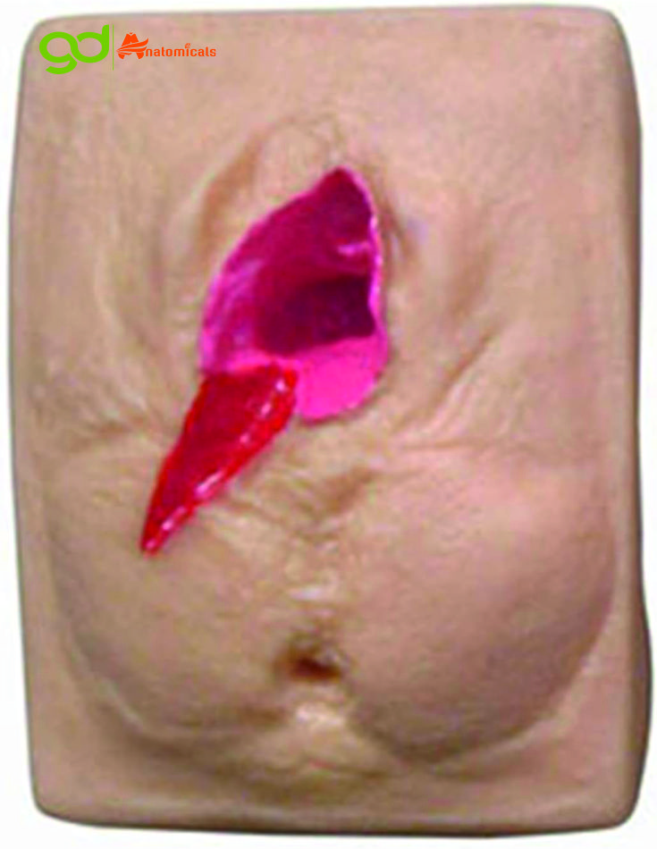 Vulva Suturing Training Model - Advantage: Realistic Feel