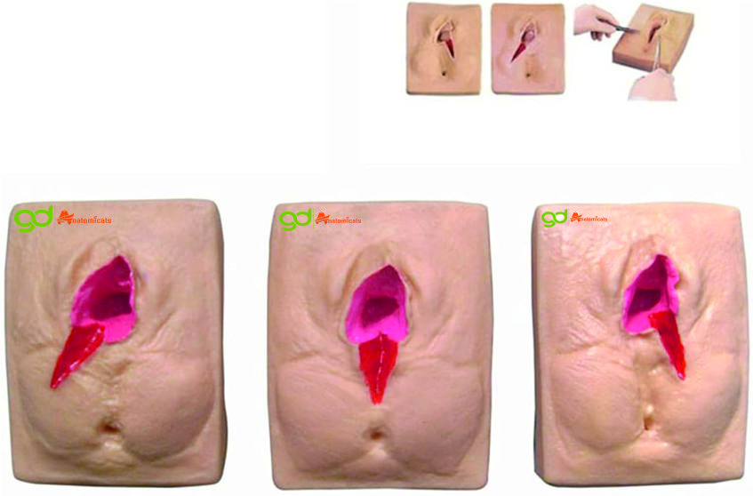 Vulva Suturing Training Model - Advantage: Realistic Feel