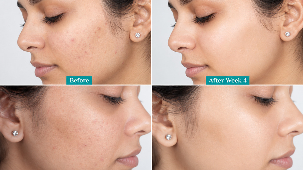 Vitamin C Serum