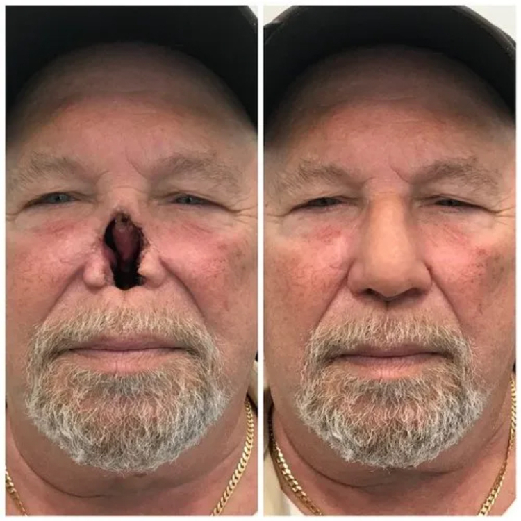 Artificial Nose