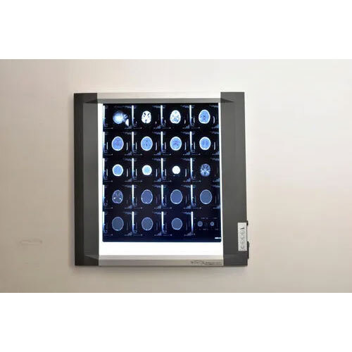 स्लिम लेड व्यू बॉक्स डार्कनेस रेंज: >10000