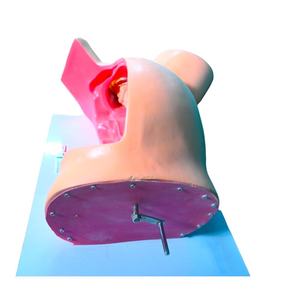 RH Model Of Course Of Delivery