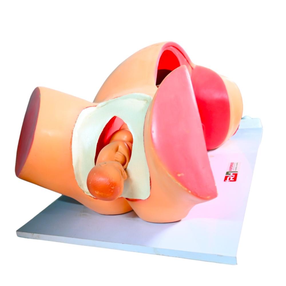 RH Model Of Course Of Delivery