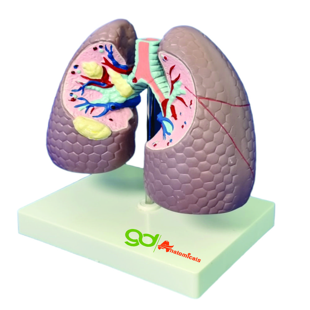 Lungs Pathology - Assembly: Ready To Use