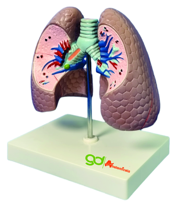 Lungs Pathology