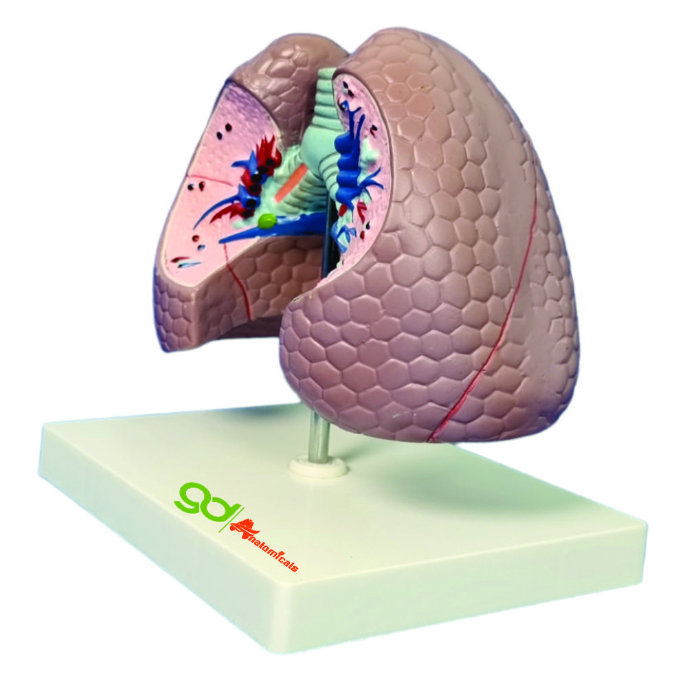 Lungs Pathology