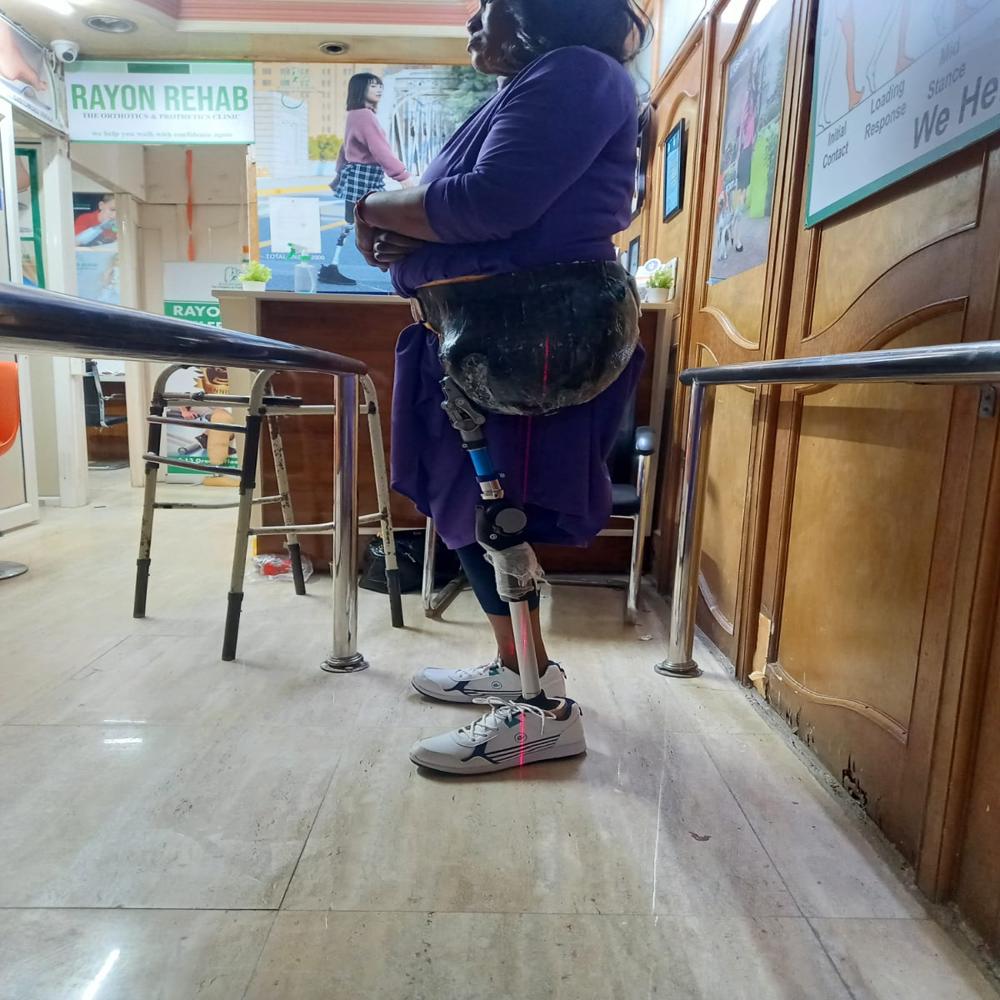 निचले अंग का कृत्रिम अंग - रेयान रेहाब